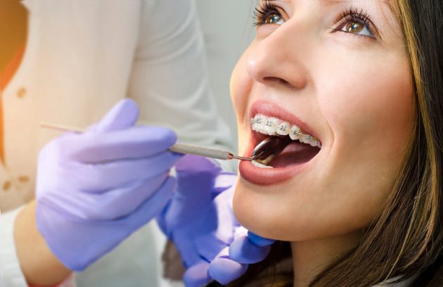 ارتودنسی دندان چیست؟ مزایا، معایب و انواع ارتودنسی دندان