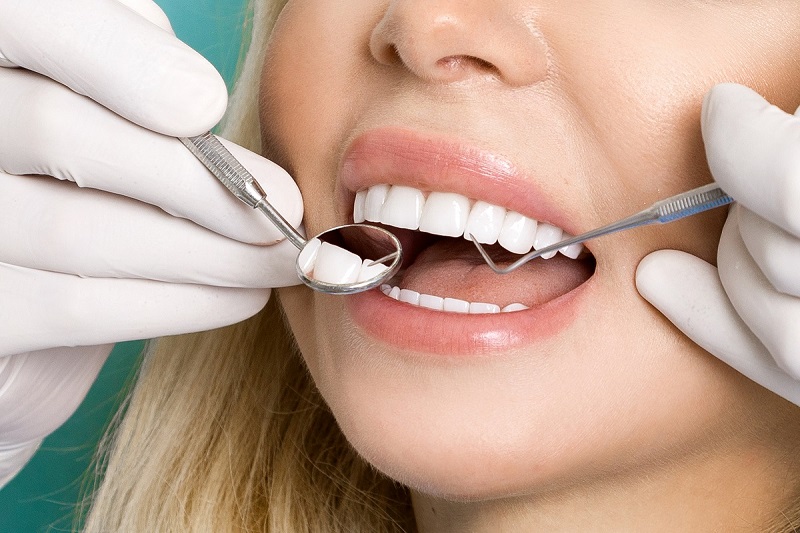 عوارض لمینت دندان و ناگفته های این روش زیبایی