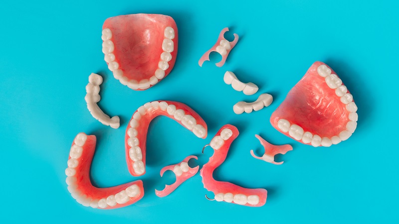 روش کاشت دندان توسط پروتز دندان مصنوعی 