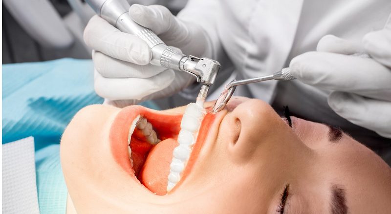 جرم‌گیری دندان چیست و چگونه انجام می‌شود؟