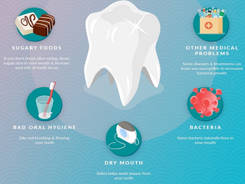 دلیل ایجاد پوسیدگی دندان 