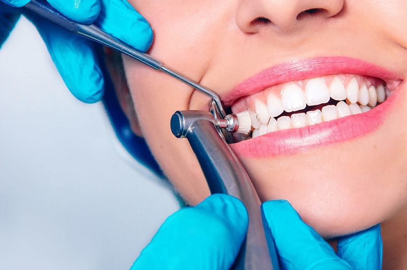 بروساژ دندان چیست ؟ ( + انواع، مزایا و معایب )