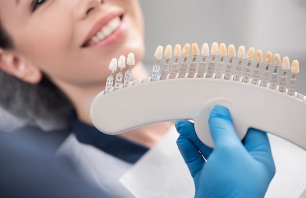 15 راه کار کلیدی جهت مراقبت از لمینت دندان