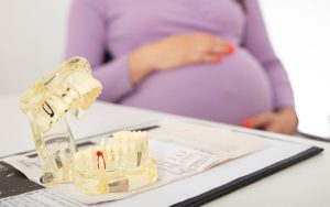 آیا امکان لمینت در دوران بارداری وجود دارد؟