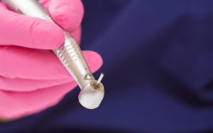 عوامل موثر در تراشیدن دندان