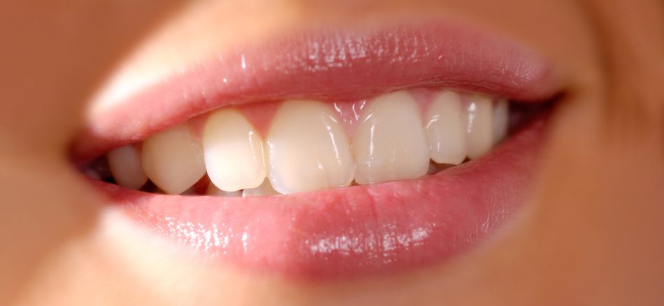 دندان خرگوشی