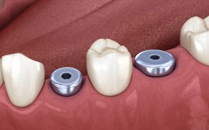 healing installation