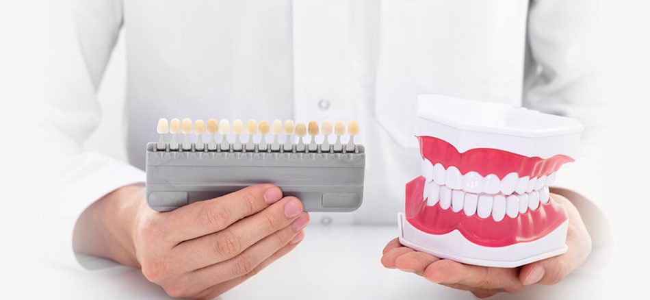 عمر لمینت دندان