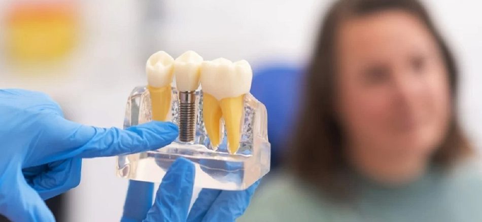 عوارض ایمپلنت دندان