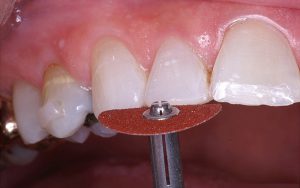 آیا اصلاح می کند؟