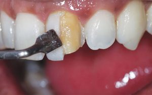 دلیل ساییدن comp7o site=